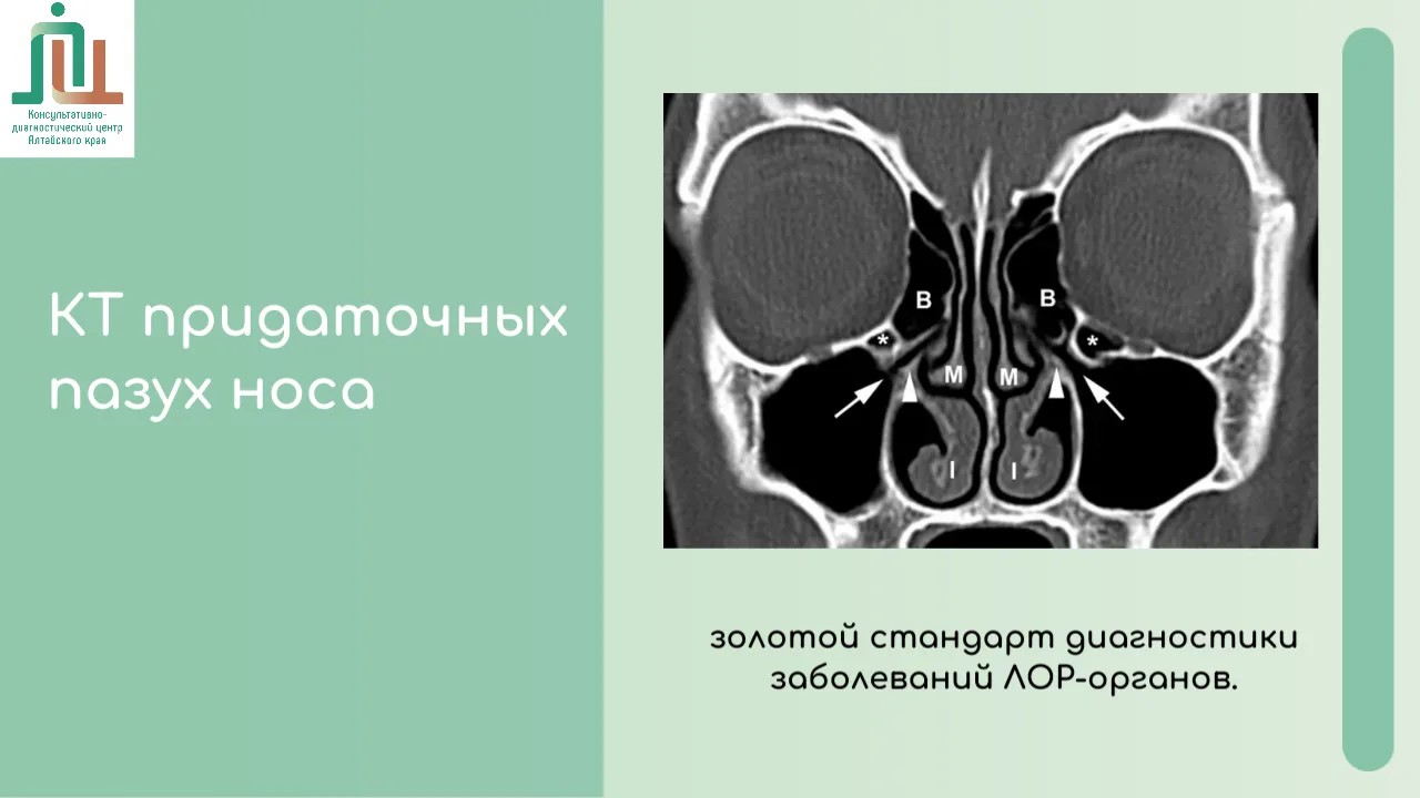 КТ придаточных пазух носа