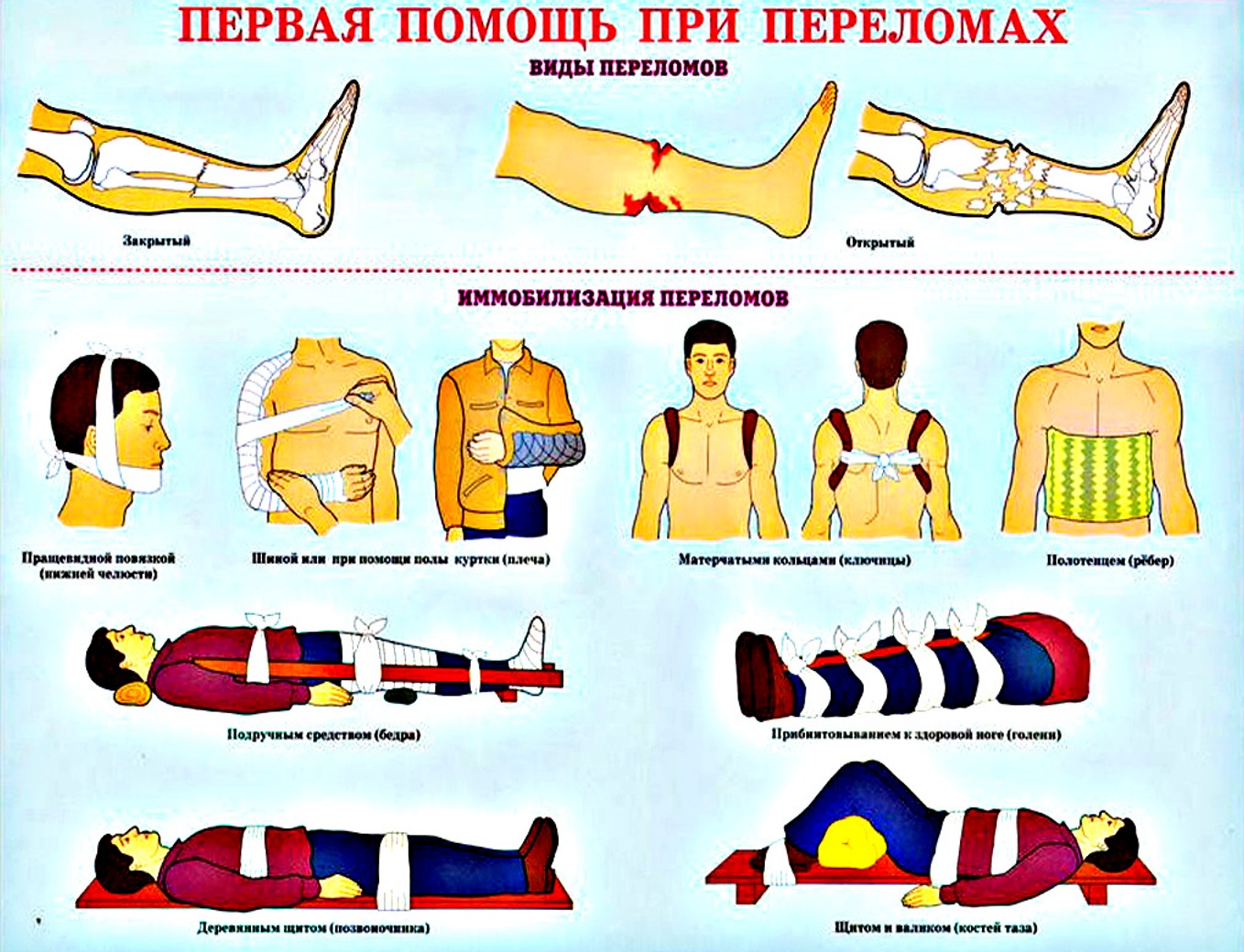 Алгоритмы первой помощи при переломах и травмах опорно-двигательного аппарата