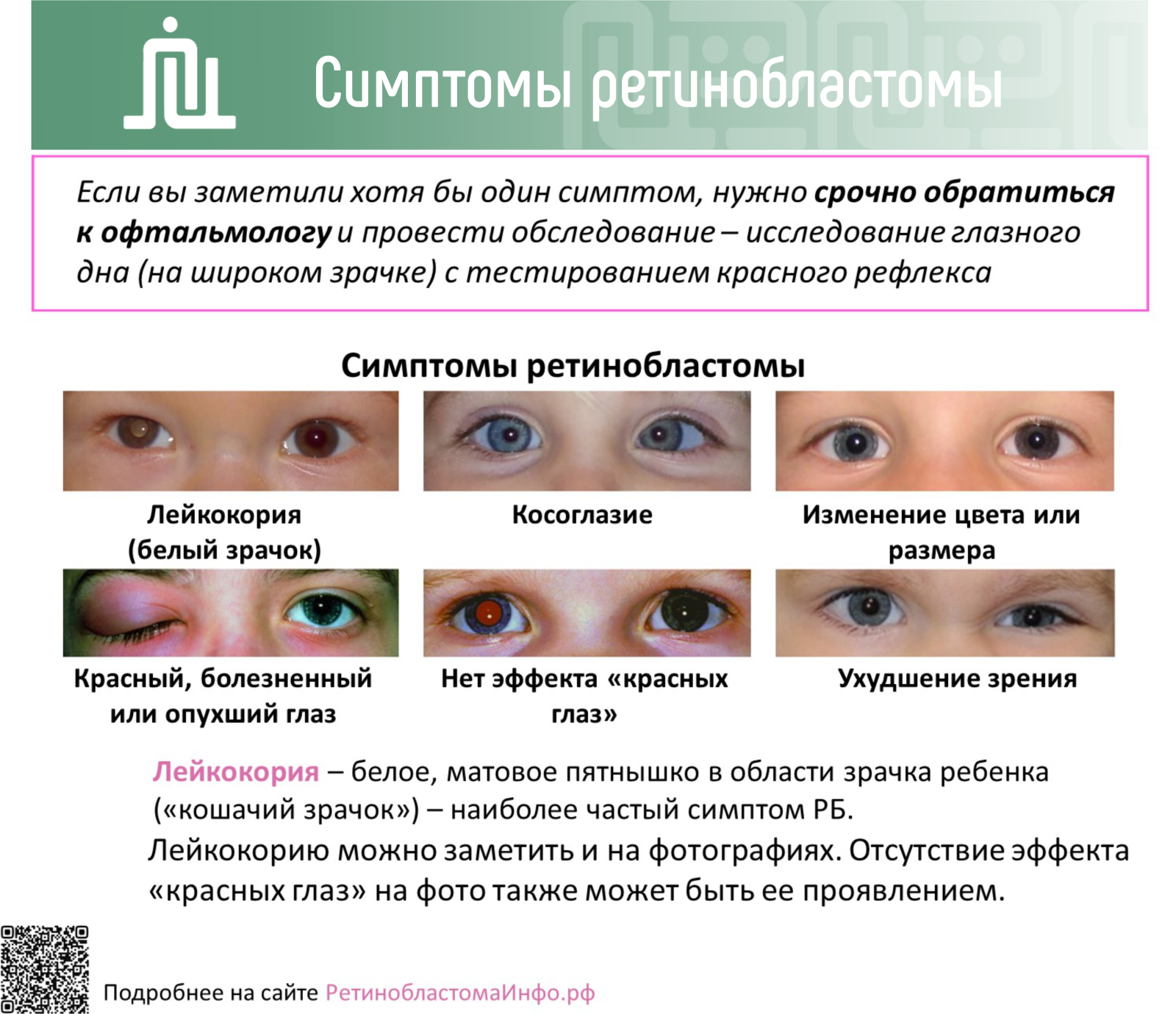 Симптомы ретинобластомы