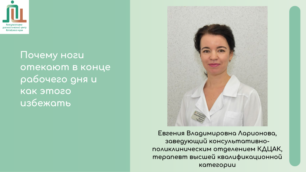 Почему ноги отекают в конце рабочего дня и как этого избежать