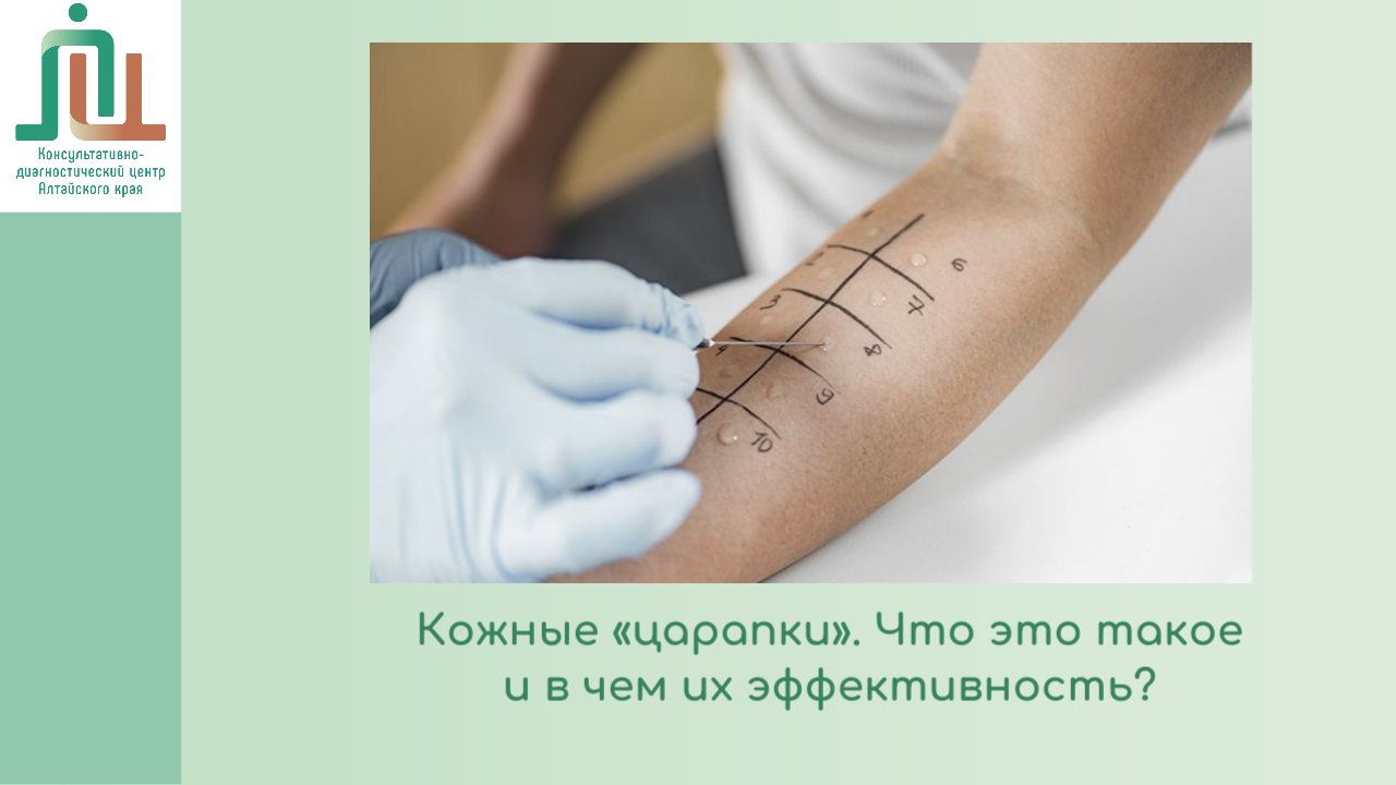 Кожные «царапки». Что это такое и в чем их эффективность?