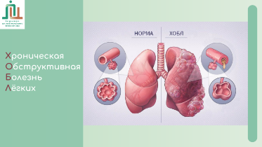 ХОБЛ: что важно знать о хронической обструктивной болезни лёгких
